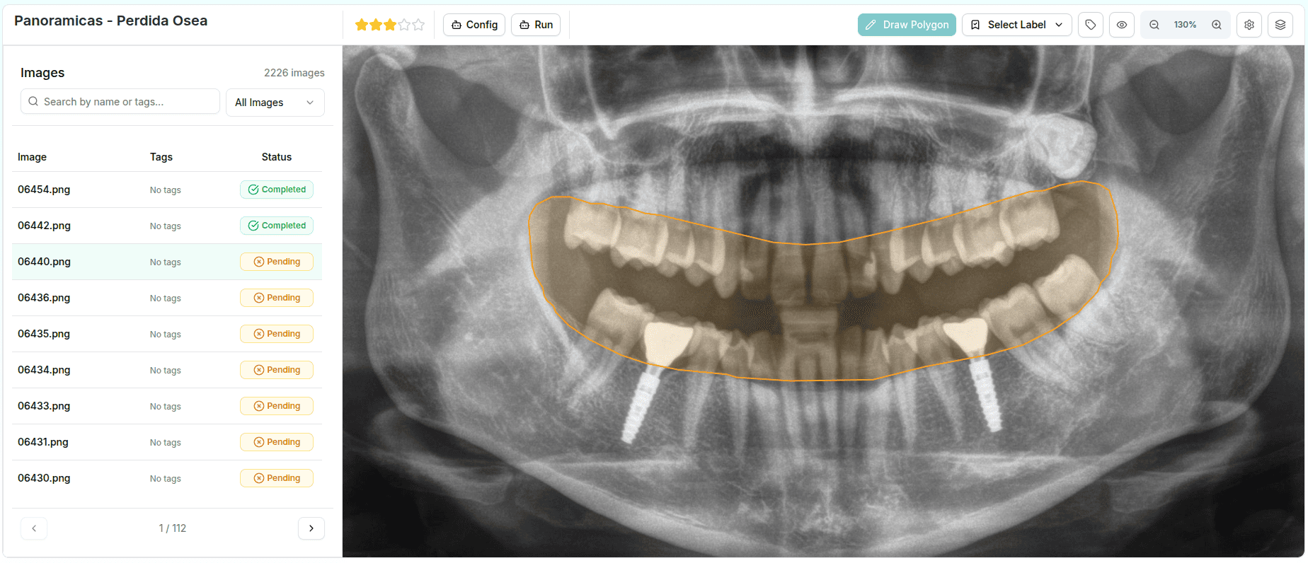 Annotia - Dental Image Annotation Tool